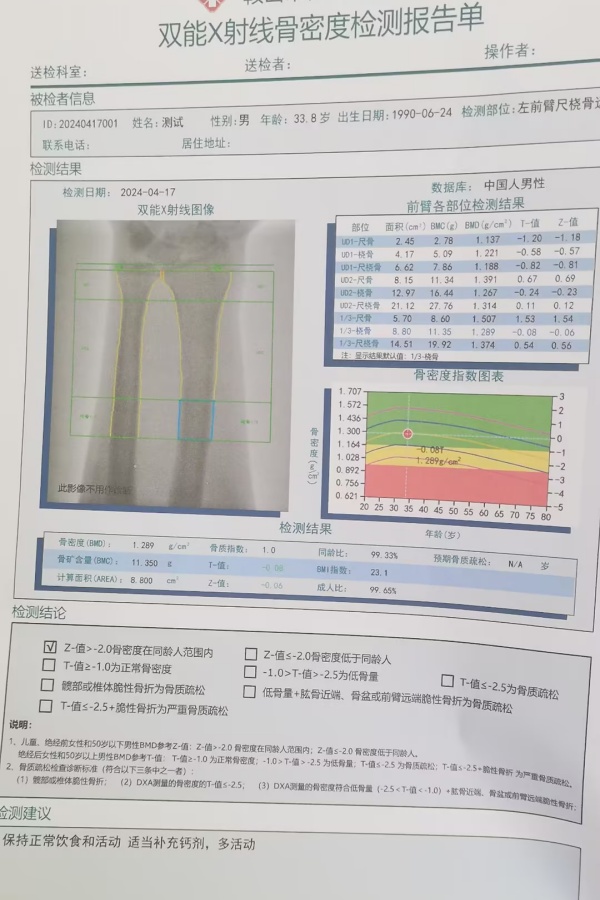 雙能X射線骨密度儀：準確測量骨密度，助力骨質(zhì)疏松防治，守護骨骼健康